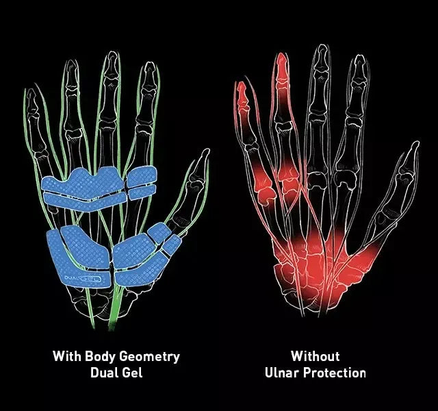 Illustration of a hand with and without ulnar protection showing body geometry and dual gel application.